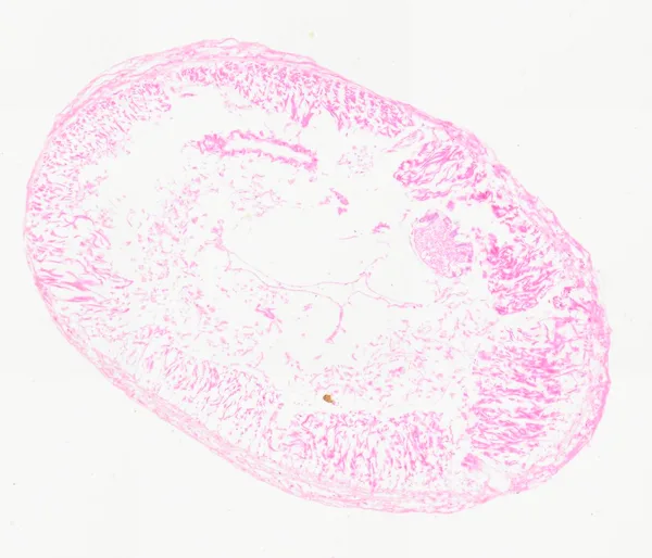 Earthworm (Cross Section) under the microscope