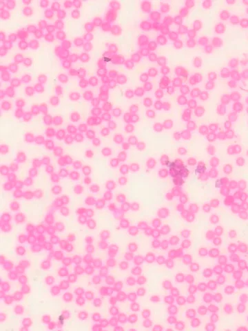Human Blood Smear under the microscope