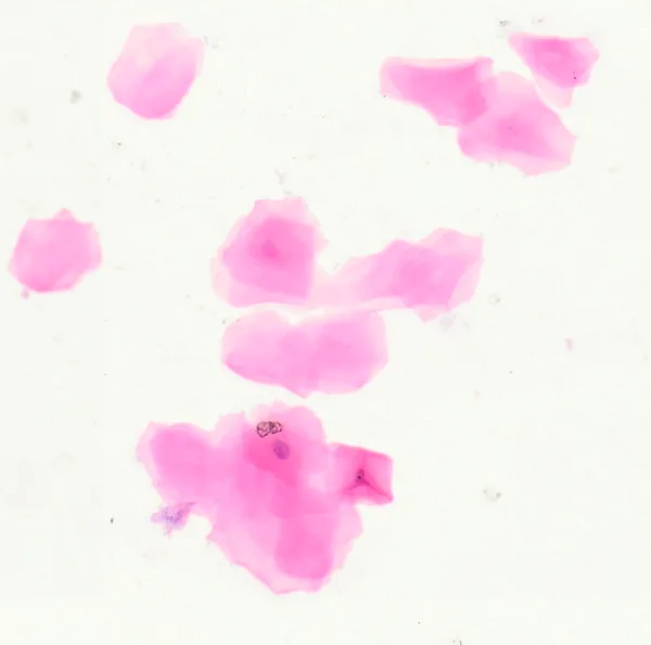 Human Cheek Cells (Whole Mount) under the microscope