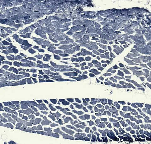 Skeletal Muscle (Transverse & Longitudinal Section) under the microscope