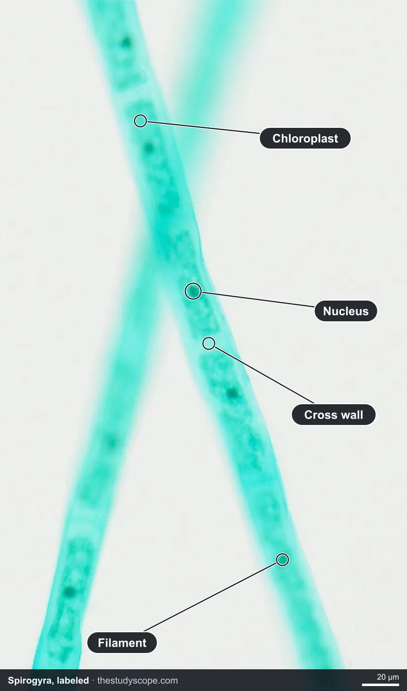 Labeled spirogyra filament under the microscope showing the chloroplast, nucleus and cross walls