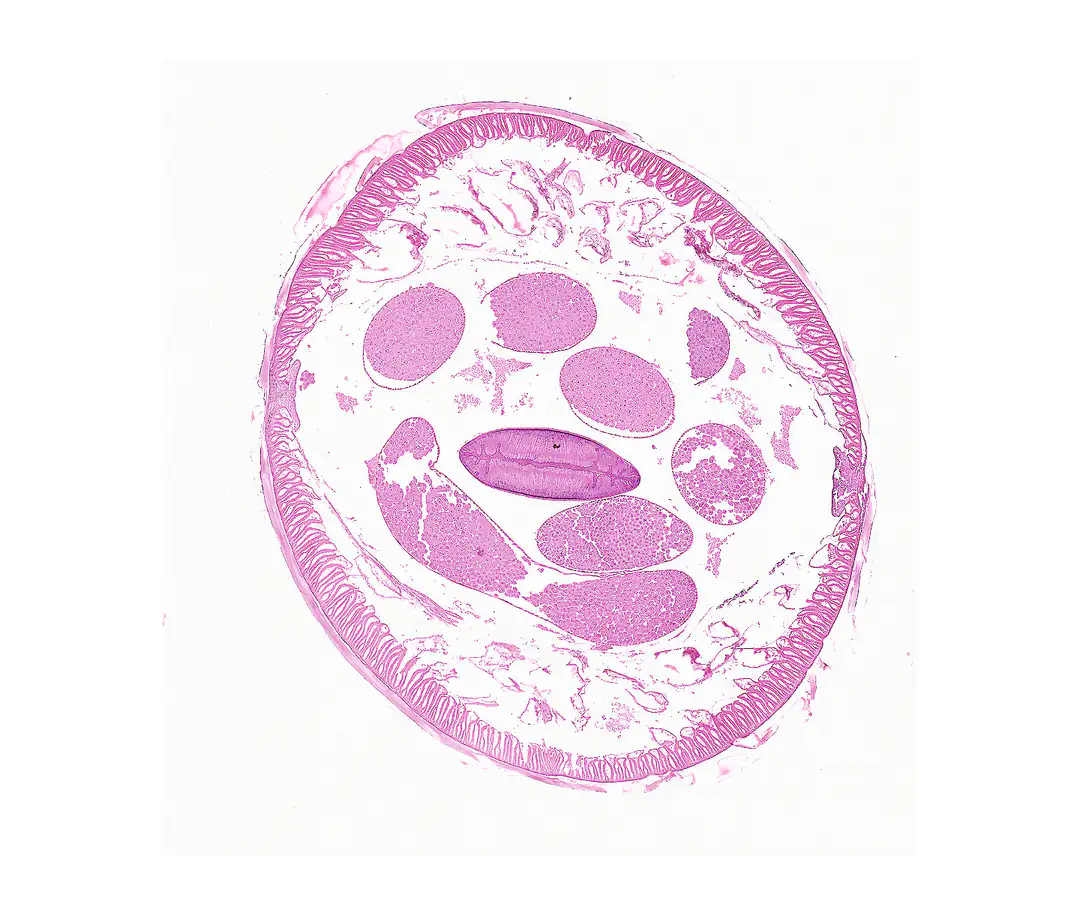 Cross section of a male Ascaris lumbricoides roundworm under the microscope, H&E stain