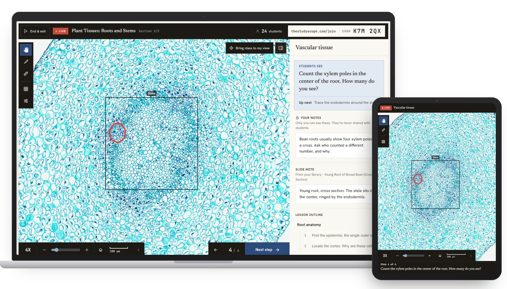 A live StudyScope lesson on a laptop, with a student tablet following the teacher's view of a bean root cross section in real time, including the teacher's circled xylem pole