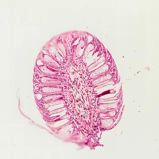 Pine Young Staminate Cone (Longitudinal Section)